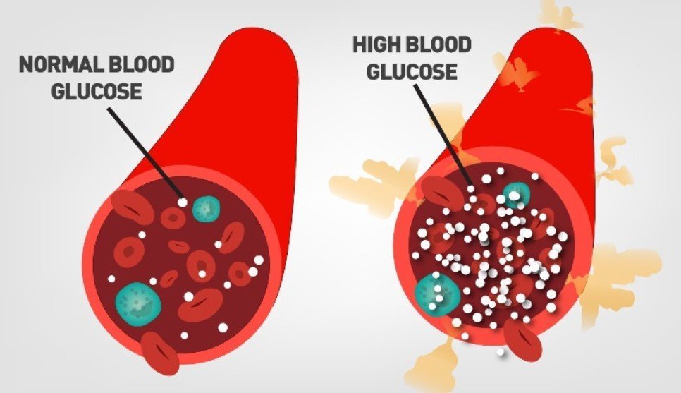 insufend-glucose.jpg